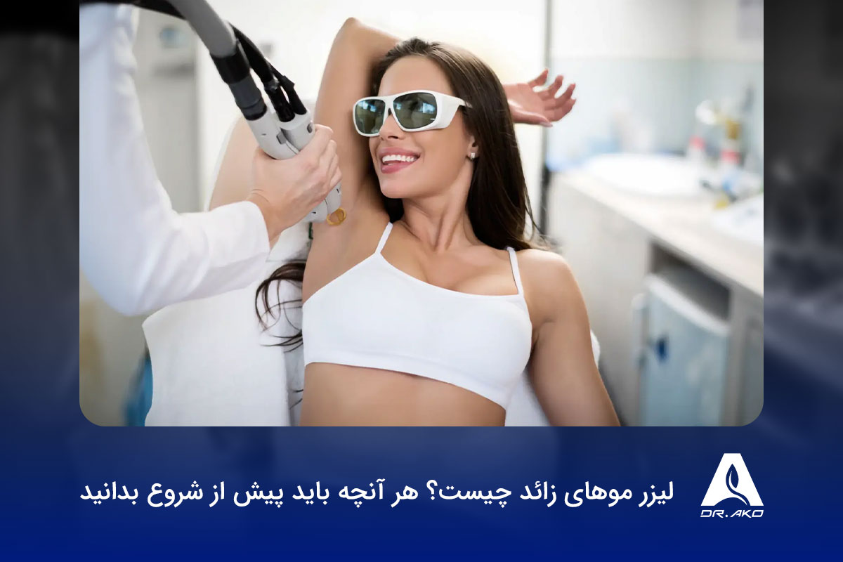 لیزر موهای زائد چیست؟ هر آنچه باید پیش از شروع بدانید